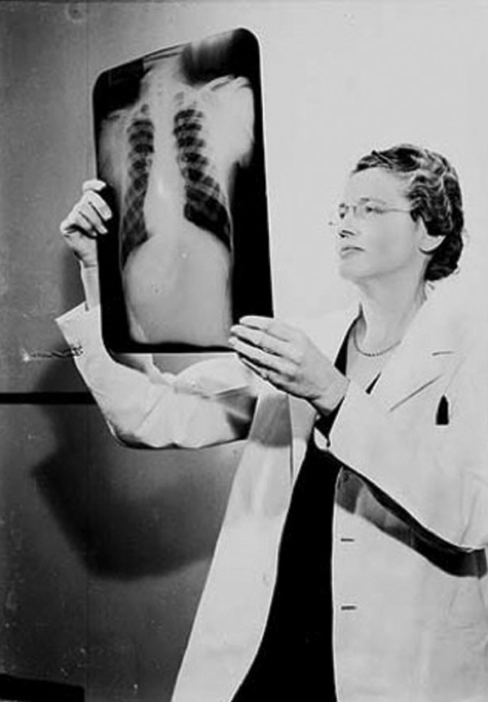 Black and white photo of young Taussig reviewing a chest x-ray.
