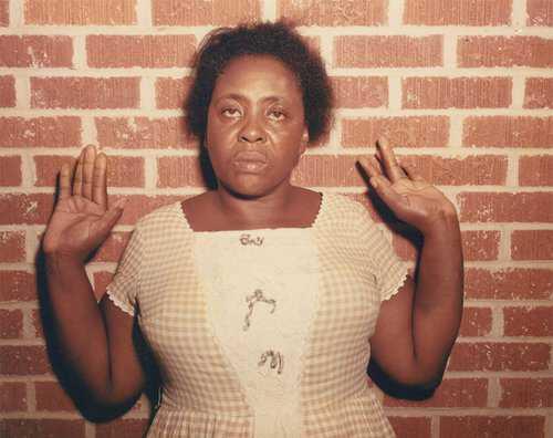 Fannie Hamer after being beaten in jail